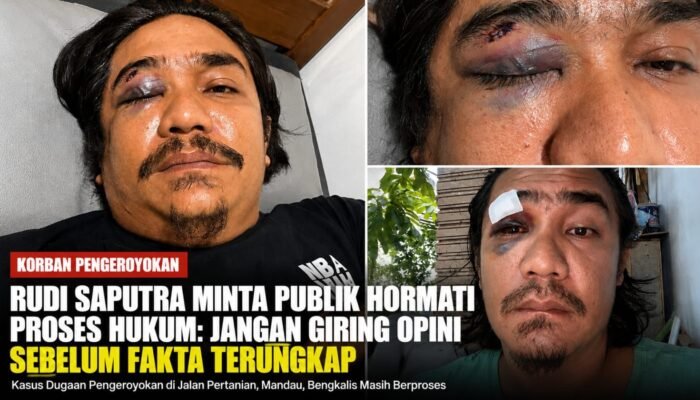 Kasus Dugaan Pengeroyokan Rudi Saputra Bergulir, Kapolsek Mandau: Penyidik Bekerja Berdasarkan Fakta dan Alat Bukti